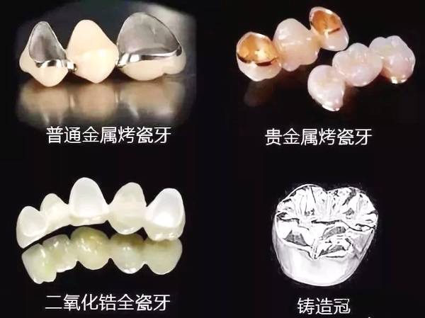 常德美奧口腔鉅惠看牙,韓國(guó)登騰種植牙3980元起,自鎖托槽矯正享5折優(yōu)惠！