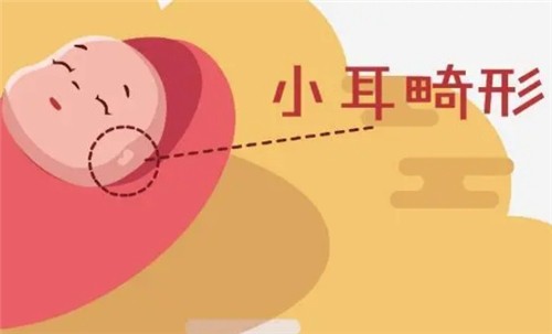 【河南中醫(yī)藥大學(xué)一附院】莊洪興教授暑假坐診，耳畸形修復(fù)限時(shí)預(yù)約！