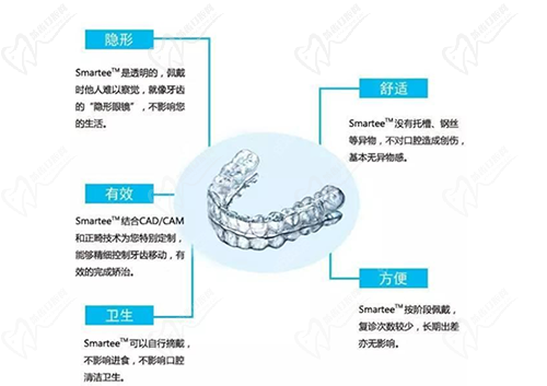 正雅隱形矯正優(yōu)勢