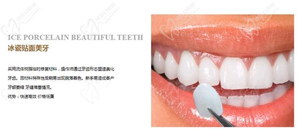 冰瓷牙和全瓷牙哪一個(gè)更好？看完冰瓷牙和全瓷牙的區(qū)別就明了