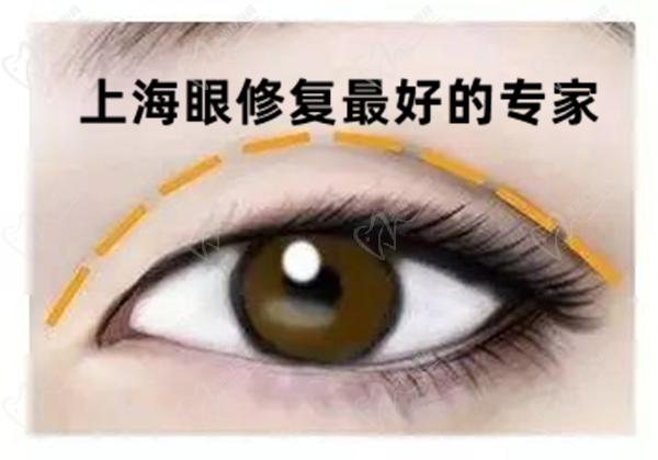 上海眼修復