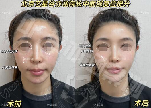 谷亦涵的技術(shù)怎么樣