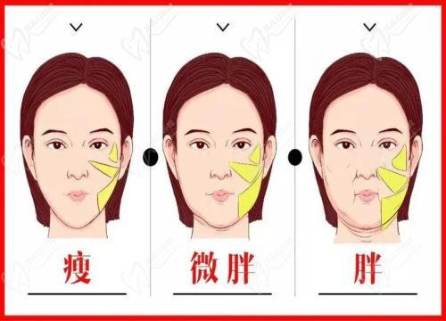 周敏茹坐診哪家醫(yī)院