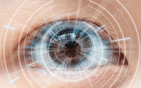 全飛秒近視手術