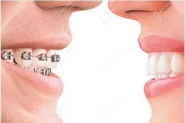拉薩雅博仕口腔醫(yī)院董海醫(yī)生對待工作的態(tài)度嚴謹