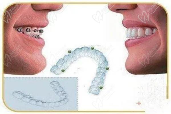 拉薩雅博仕口腔醫(yī)院董海醫(yī)生怎么樣？看醫(yī)生簡介可見矯正經(jīng)驗多