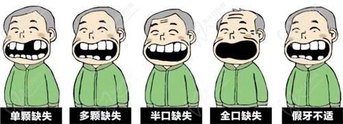 杭州種植牙哪家醫(yī)院好？