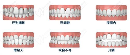 杭州整形醫(yī)院口腔科牙齒矯正多少錢？