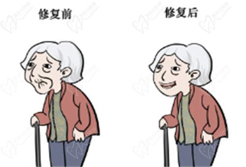 三、2025年牙冠常見材料與價格分析