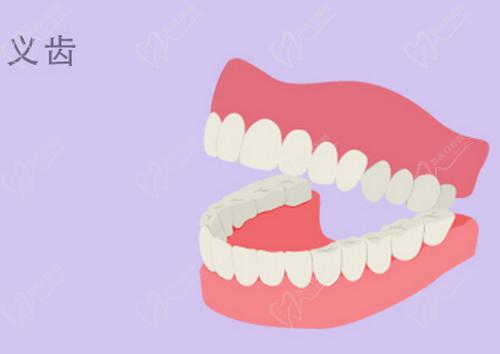 國(guó)內(nèi)滿口吸附性義齒的價(jià)格是多少