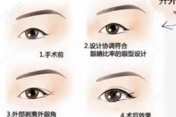 伊光醫(yī)生眼綜合費用查詢