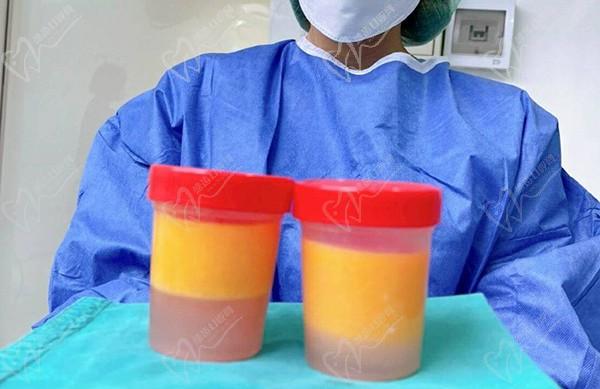 泰國拉低喃醫(yī)美中心抽脂