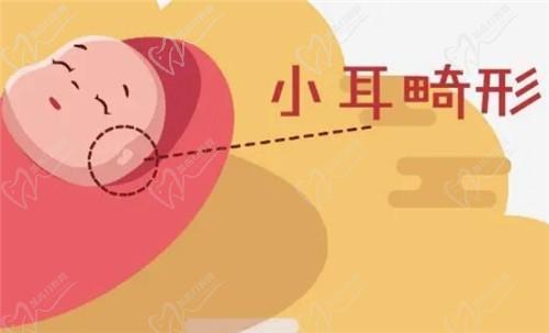【河南中醫(yī)藥大學一附院】莊洪興教授暑假坐診，耳畸形修復限時預約！