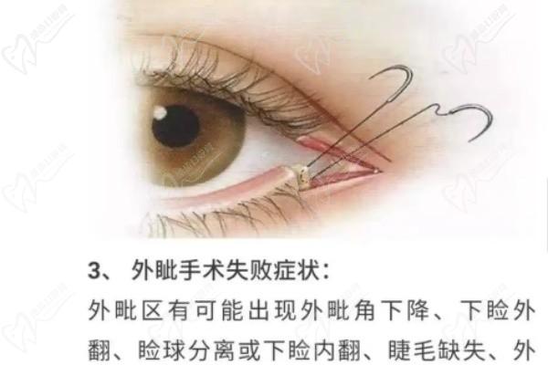 北京三仁伊光醫(yī)生雙眼皮切的怎么樣？在北京微整界非常受歡迎來看個人資料簡介